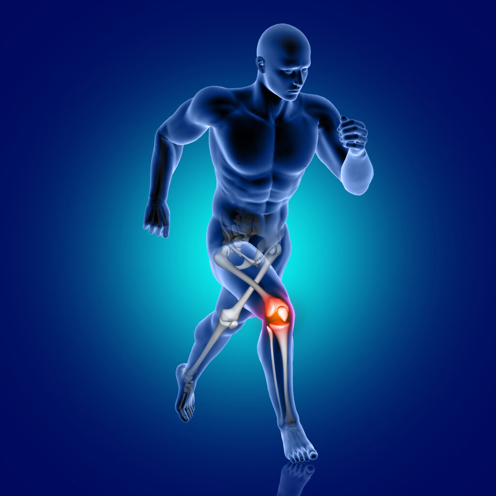 Can Ayurveda Cure Arthritis