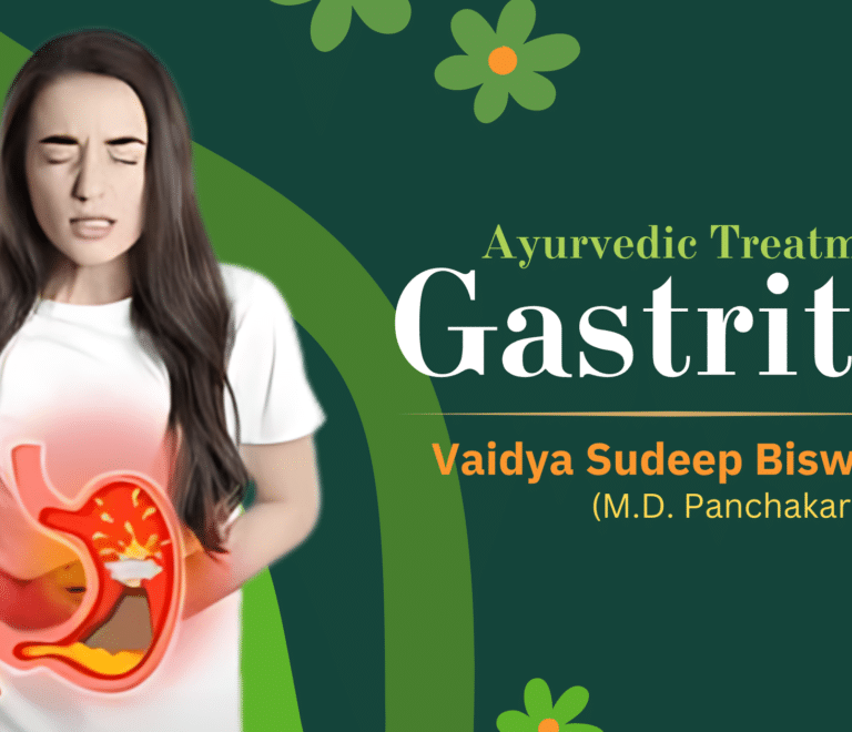 Ayurvedic Treatment for Gastritis