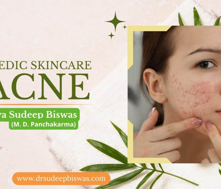 Ayurvedic Skincare for Acne